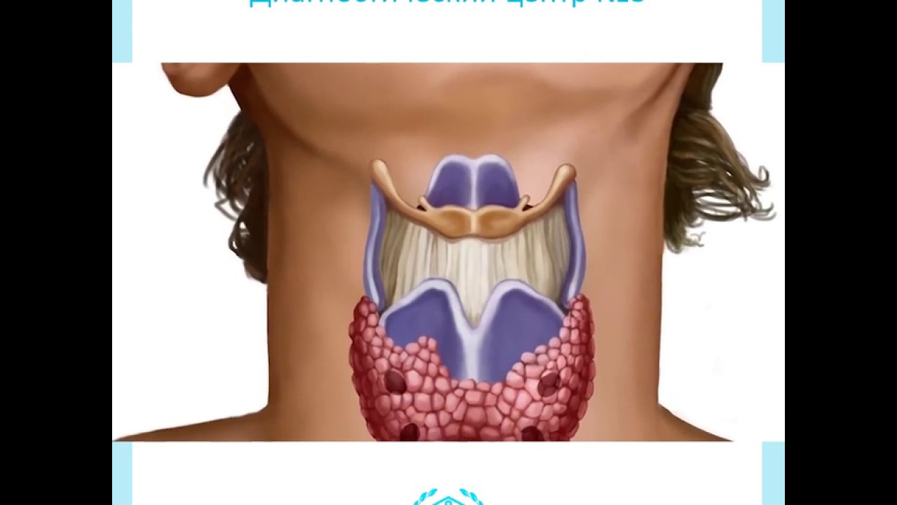 День щитовидной железы картинки