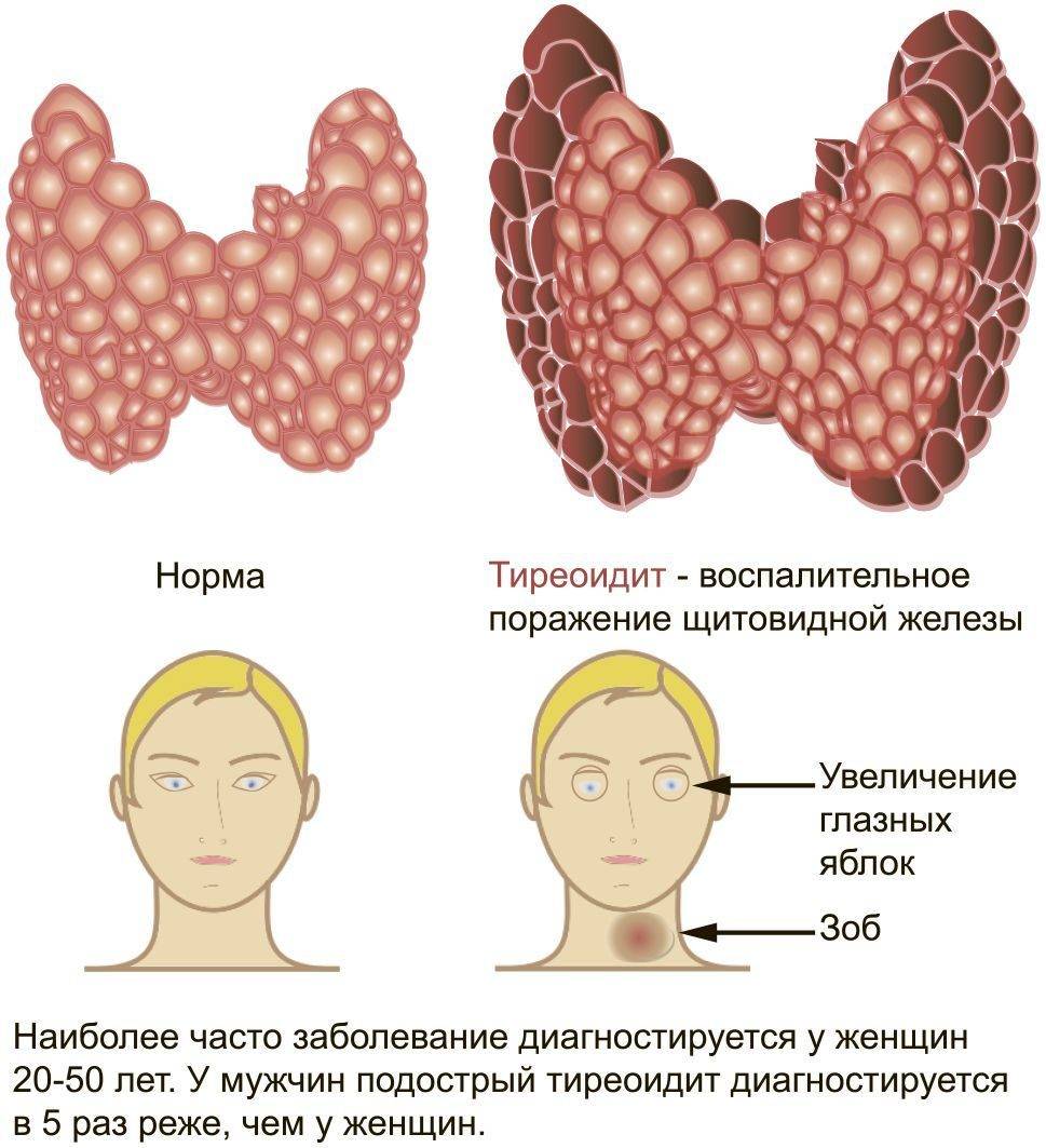 Изображение щитовидной железы