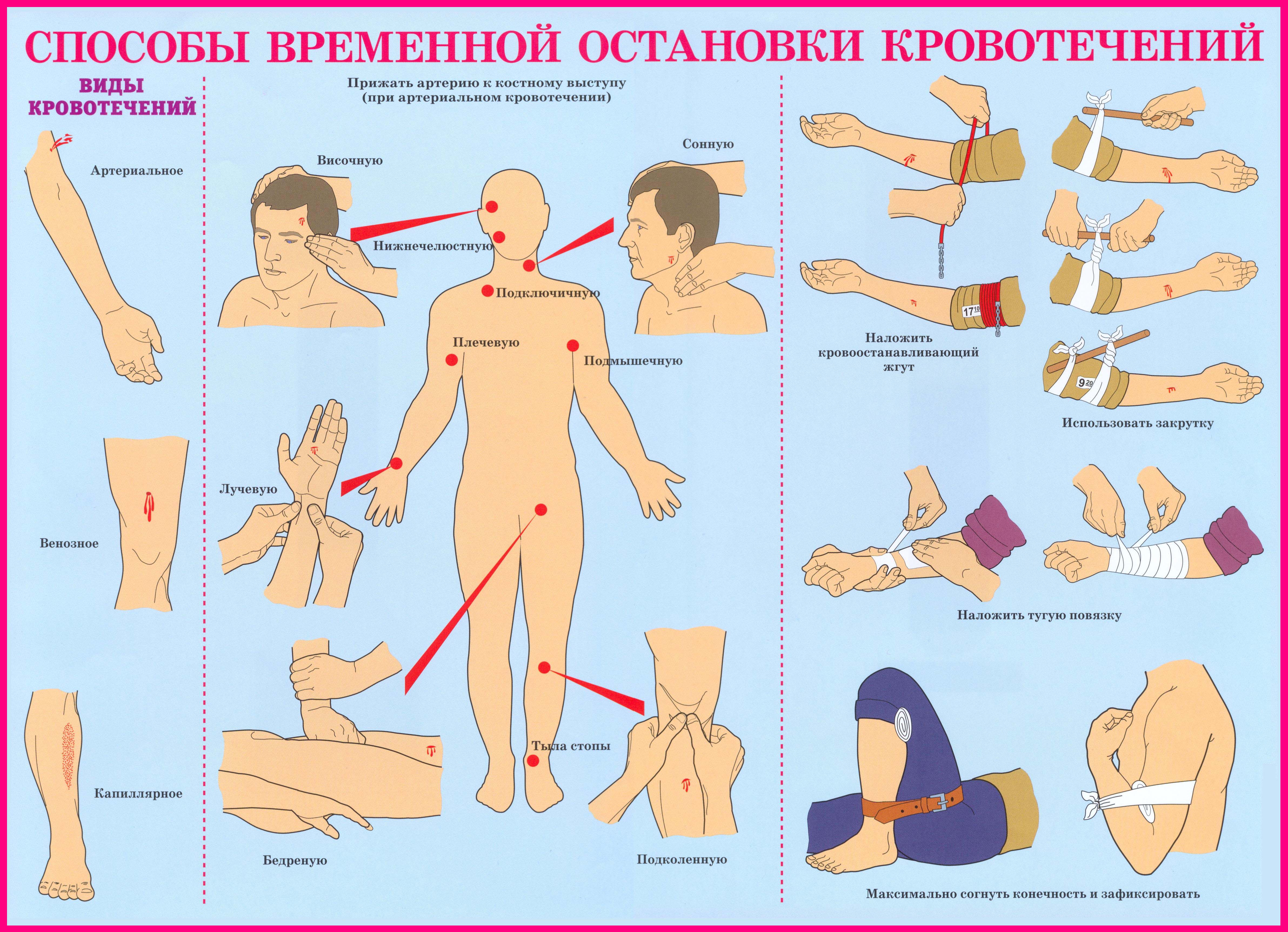 День оказания первой медицинской помощи (69 изображений)